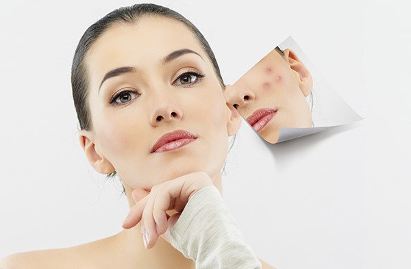 Làm sạch da là bước quan trọng, đặc biệt khi da kích ứng. Tẩy trang giúp loại bỏ dầu thừa, bụi bẩn và cặn mỹ phẩm
