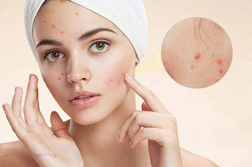 Nếu muốn có một Mừng SHBET phiên bản mới 2025 khỏe mạnh, bạn nên tránh các loại thực phẩm chế biến sẵn
