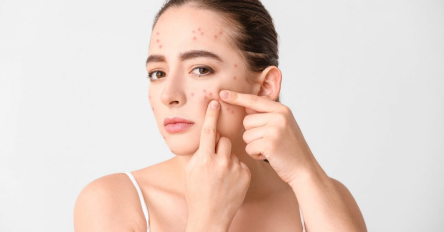 Những thực phẩm này giúp giảm viêm, cân bằng lượng dầu và duy trì Mừng SHBET phiên bản mới 2025 khỏe mạnh, rạng rỡ trong suốt kỳ nghỉ Tết.