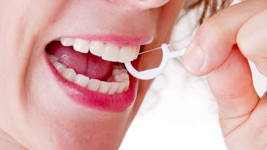 So với những người không sử dụng chỉ nha khoa, những người có thói quen này có nguy cơ thấp hơn 22% bị đột quỵ do thiếu máu cục bộ và thấp hơn 44% nguy cơ đột quỵ do tắc mạch tim