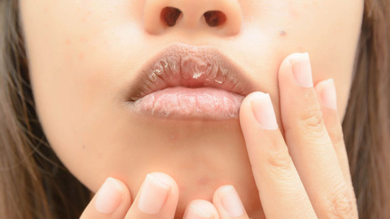 Nhiều chị em gặp phải tình trạng khô môi sau khi sử dụng son bóng.