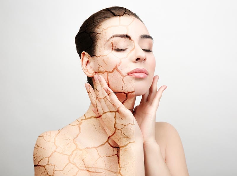  Nếu Sh88bet đăng ký miễn phí không được cung cấp đủ nước, da sẽ bị khô, mất đi độ ẩm cần thiết. 