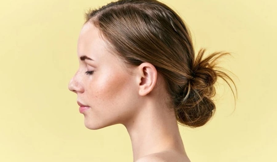 Tăng sắc tố là tình trạng xuất hiện các đốm nâu hoặc vùng da sạm màu do melanin sản xuất quá mức. 