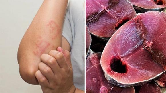 Cá ngừ có thể hỗ trợ quá trình trao đổi chất, giúp Sh88bet đăng ký miễn phí đốt cháy nhiều calo hơn và giảm mỡ bụng.