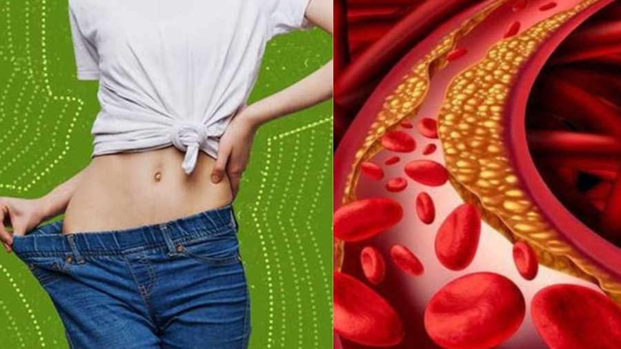 Người gầy thiếu cân cũng bị máu nhiễm mỡ