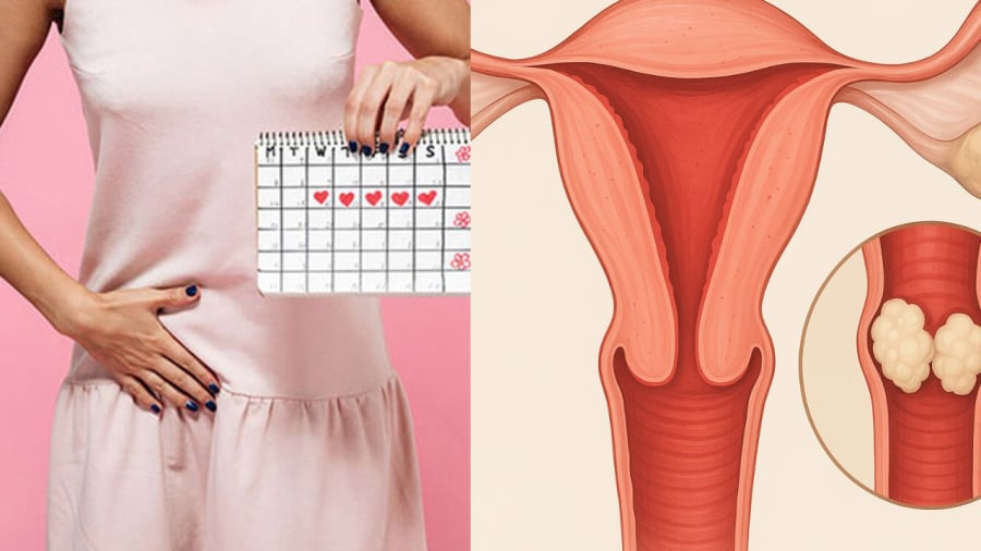 Xuất hiện chảy máu âm đạo bất thường chị em nên cảnh giác