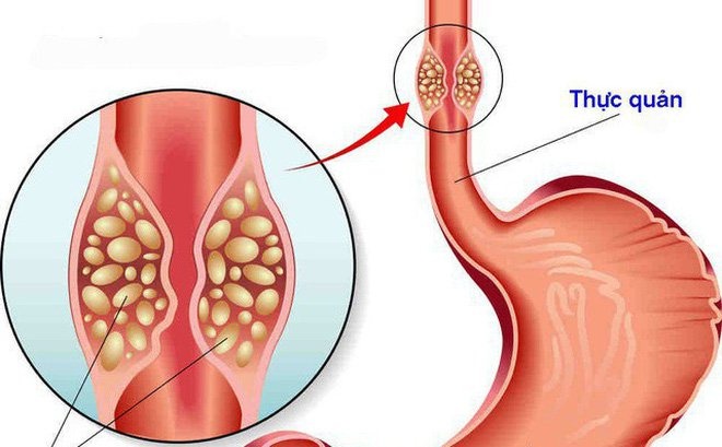 RSST không phải là mẹo dân gian, mà được chứng minh hiệu quả qua Shbet888.com tỷ lệ cược cao đăng trên tạp chí Dysphagia của nhóm bác sĩ tại Trung tâm Y tế Sheba (Israel). 