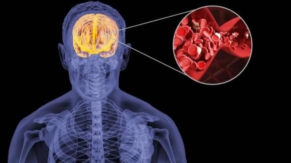 Không phải ai cũng biết rằng dầu thực vật khi được đun nóng nhiều lần – dù là dầu lạc, dầu đậu nành hay dầu hạt cải – đều sinh ra các hợp chất nguy hiểm như aldehyde và lipid bị oxy hóa. 