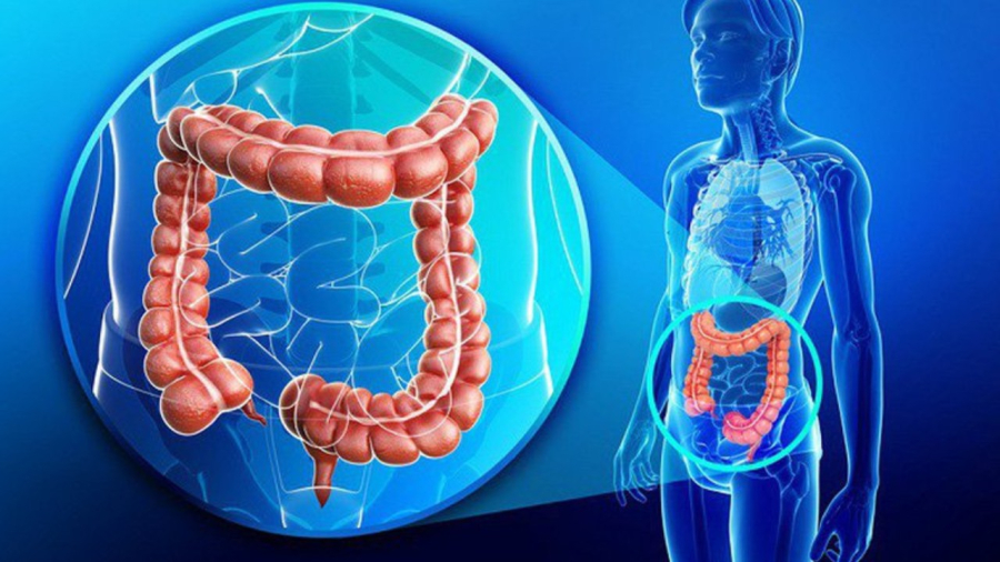 8 dấu hiệu ung thư đại tràng giai đoạn sớm, số 3 cực kỳ phổ biến
