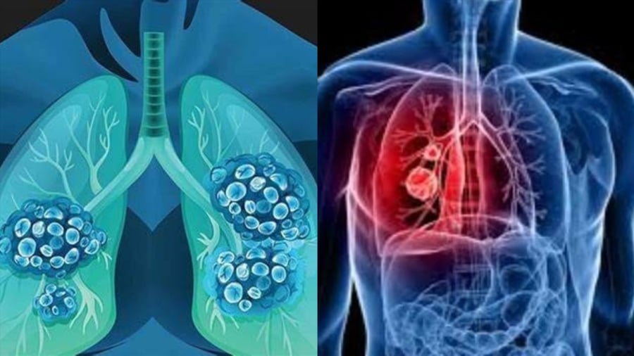 6 dấu hiệu Sh88bet đăng ký miễn phí đang 'nuôi mầm' bệnh K, số 1 nhiều người bỏ qua nhất