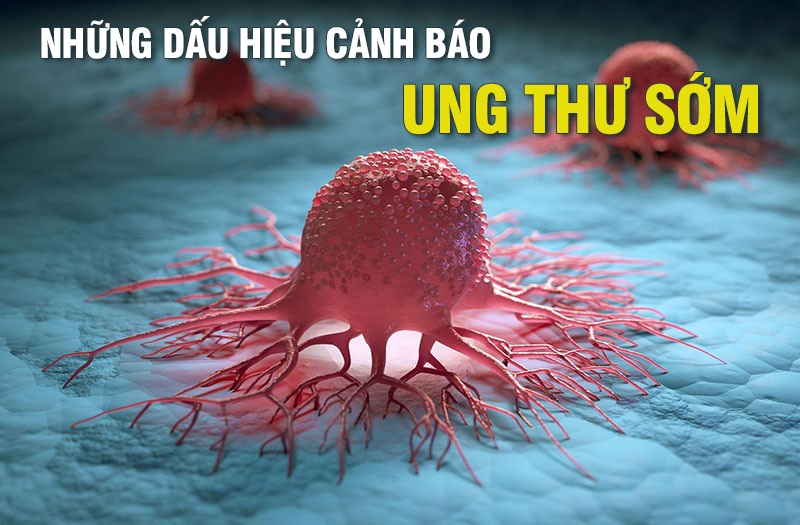 6 dấu hiệu Sh88bet đăng ký miễn phí đang 'nuôi mầm' bệnh K, số 1 nhiều người bỏ qua nhất