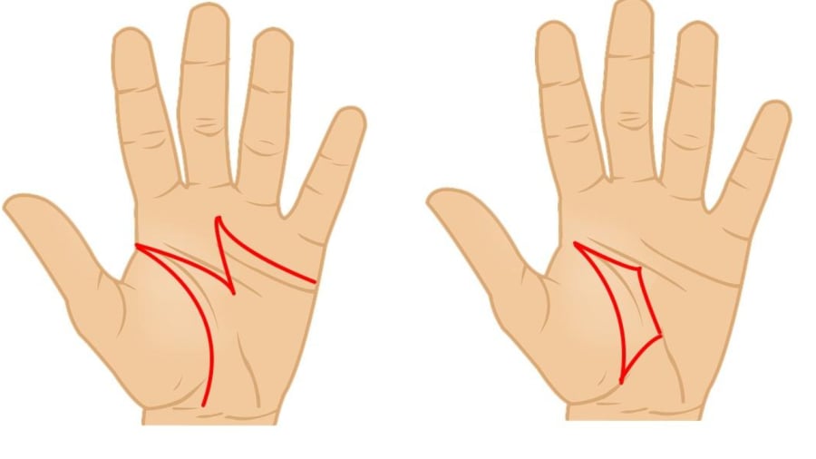 Đường chỉ tay chữ M (bên trái) và đường chỉ tay thỏi vàng.