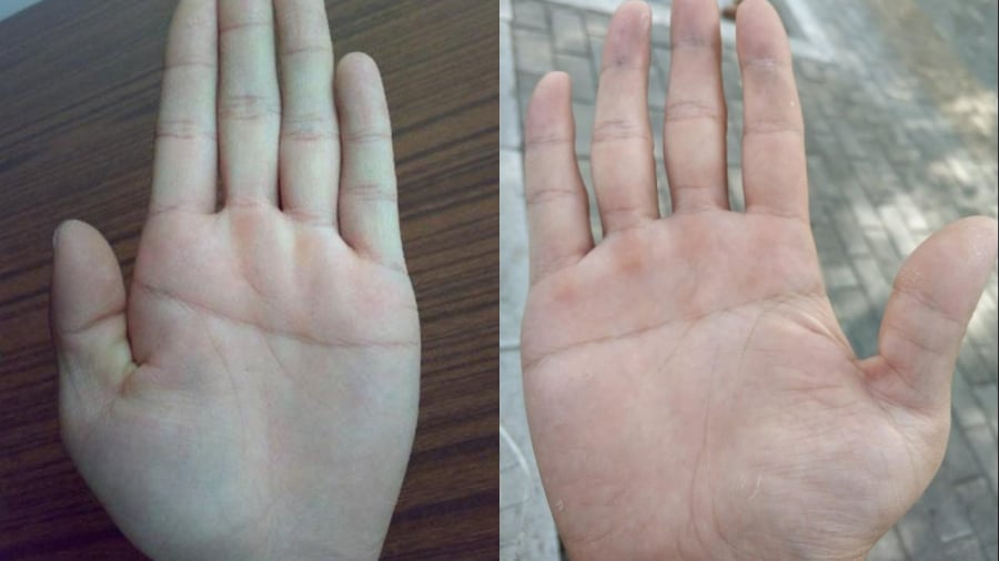 Đường chỉ tay chữ Nhất là đường chỉ tay cực hiếm gặp.