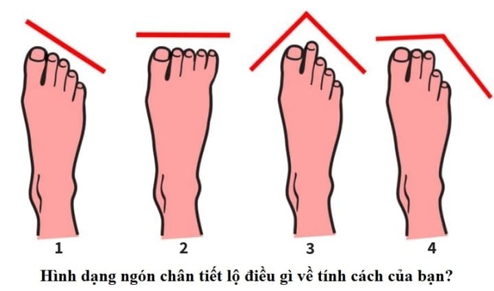 Đây là kiểu bàn chân 