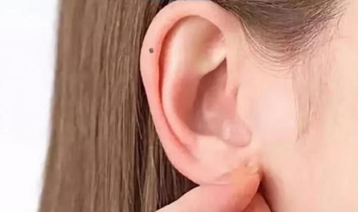 Phụ nữ có nốt ruồi trên tai phải
