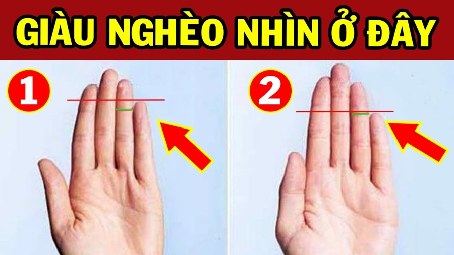 Xem độ dài ngón út, biết ngay ai nghèo hèn mạt kiếp, ai sinh ra 