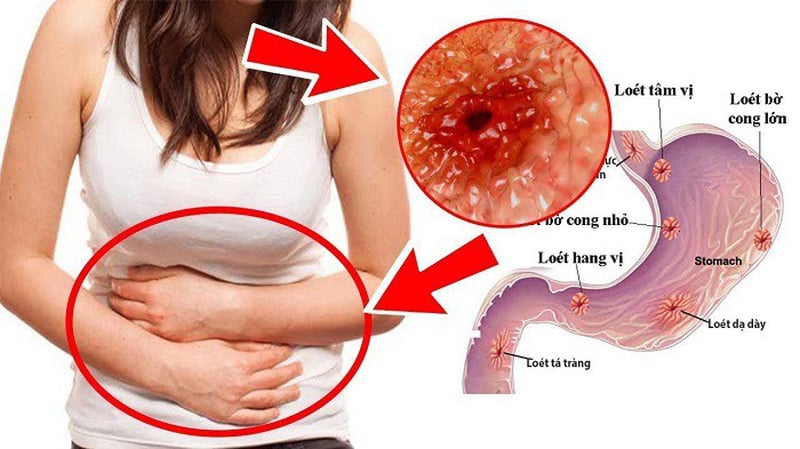 Cảnh báo dấu hiệu ung thư Shbet123 Link Vào ShBet Mới Nhất