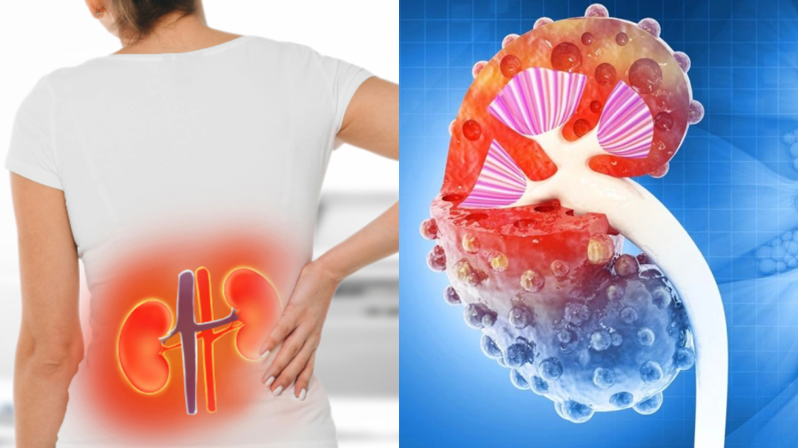 Suy thận dẫn tới Sh88bet đăng ký miễn phí luôn ở trọng trạng thái mệt mỏi.