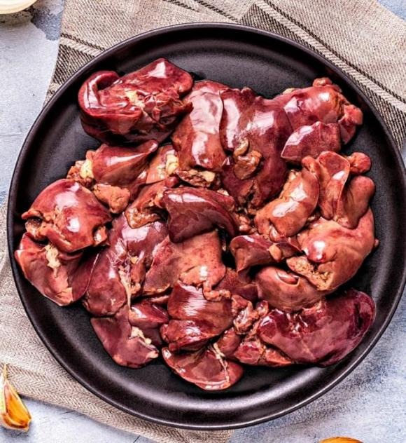 Cholesterol dư thừa tích tụ trong thành mạch, tạo mảng bám gây xơ vữa, khiến động mạch hẹp và cứng lại. 