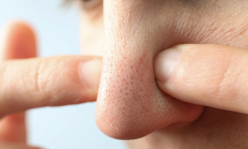  Thay vì phụ thuộc vào các phương pháp đắt đỏ, bạn hoàn toàn có thể tự chăm sóc tại nhà 