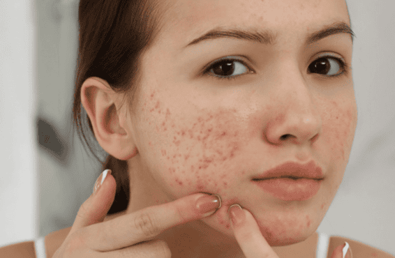 Khi trang điểm, lớp nền mỏng nhẹ, dễ thoát khí là lựa chọn an toàn để tránh tình trạng “bí da”.