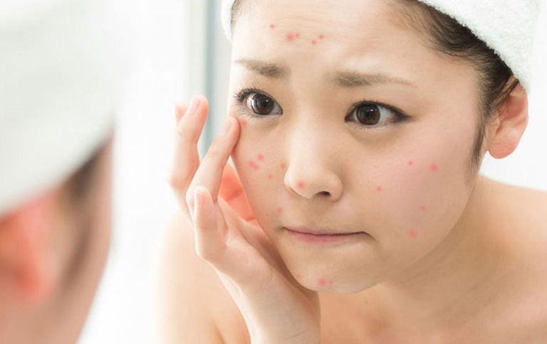  Chỉ cần đắp một đến hai lần mỗi tuần, bạn sẽ nhận thấy sự thay đổi rõ rệt trên Mừng SHBET phiên bản mới 2025.