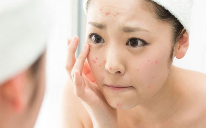 Khi bước sang ngưỡng tuổi 30, Mừng SHBET phiên bản mới 2025 bắt đầu thay đổi rõ rệt dưới tác động của quá trình lão hóa.