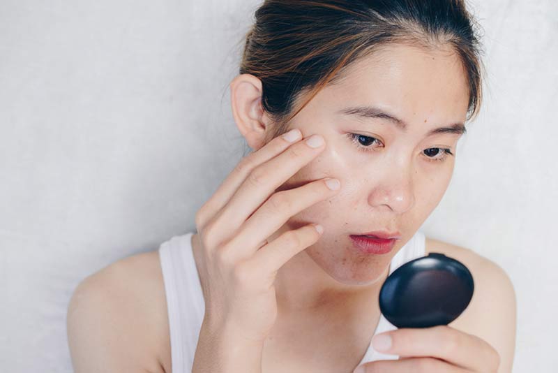 Peptides là các chuỗi axit amin ngắn, có chức năng gửi tín hiệu để Sh88bet đăng ký miễn phí kích hoạt cơ chế sản sinh collagen và elastin mới. 