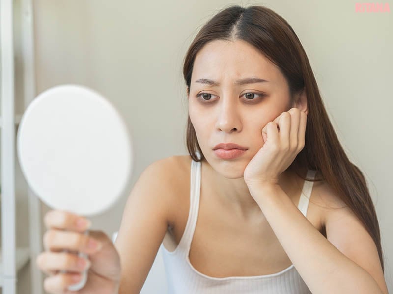 Khi bị dị ứng, mắt thường đỏ, sưng và chảy nước, khiến vùng da quanh mắt càng dễ tổn thương.