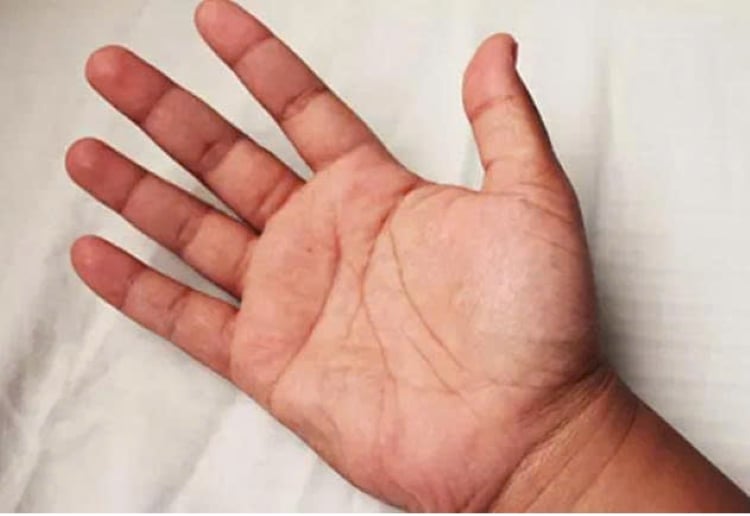 Lòng bàn tay da dẻ hồng hào và mượt mà cho thấy chủ nhân là người có phúc khí, thân thể khỏe mạnh. (Ảnh minh họa)