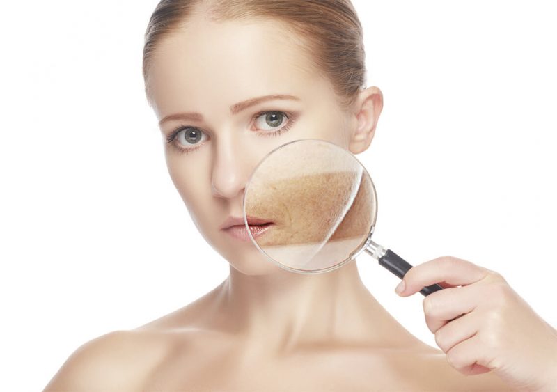 Một loại kem chống nắng quang phổ rộng, SPF từ 30 trở lên, được thoa đều đặn và lặp lại sau vài giờ chính là “vũ khí” cần thiết 