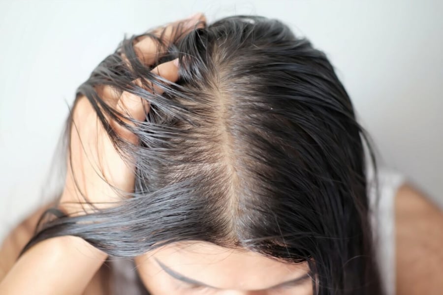 Hãy chọn sản phẩm tẩy tế bào chết da đầu với thành phần tự nhiên như muối biển, tràm trà hoặc AHA/BHA nồng độ thấp.