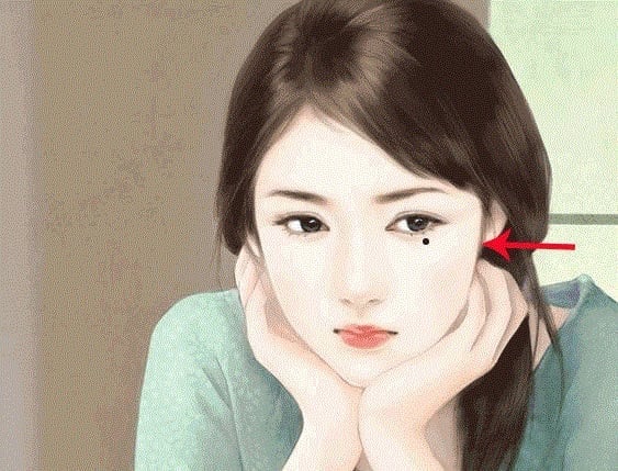 Nốt ruồi kém may mắn