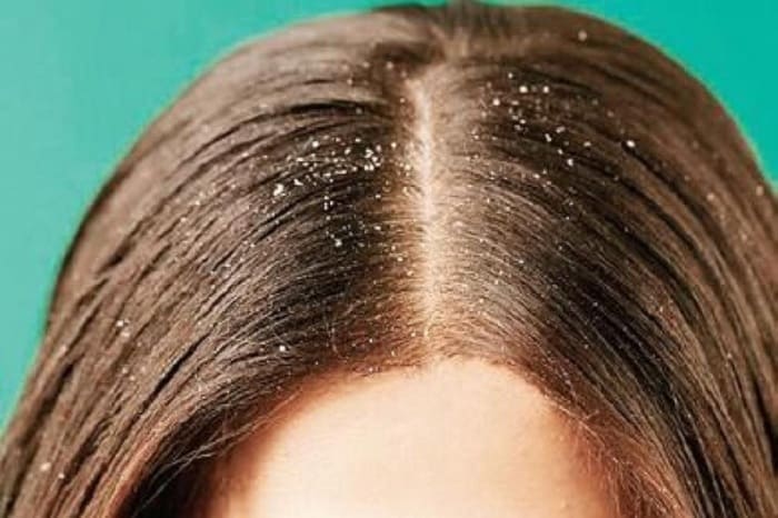 bạn nên sấy tóc khô hẳn trước khi ngủ, ưu tiên nhiệt độ thấp hoặc trung bình để tránh làm tổn thương cấu trúc tóc và bảo vệ da đầu khỏe mạnh.    