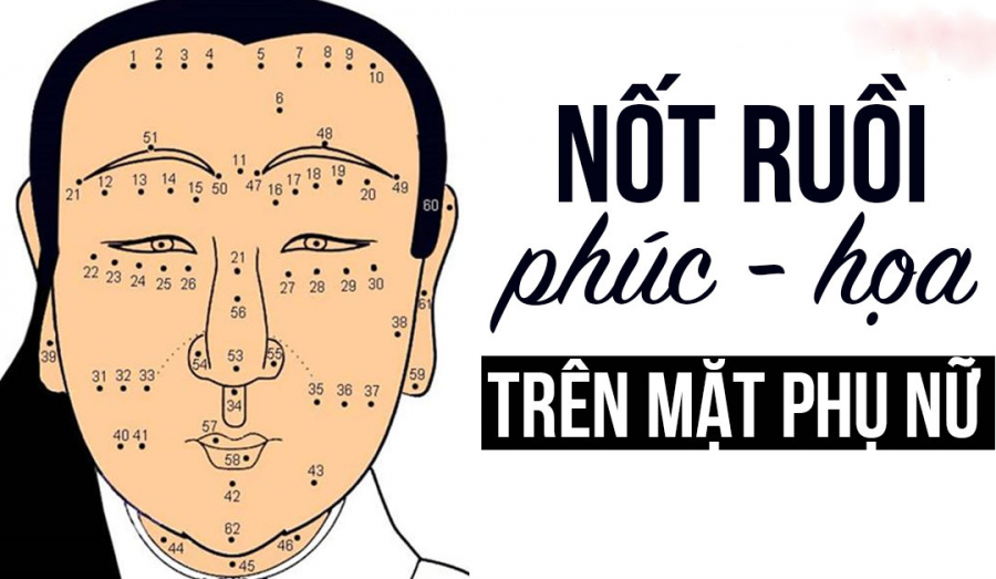 not ruoi