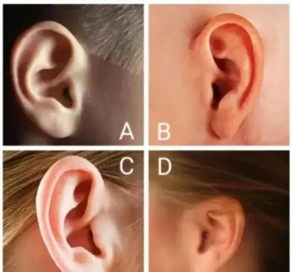 Hãy chọn 1 chiếc tai trông giống bạn nhất nhé!