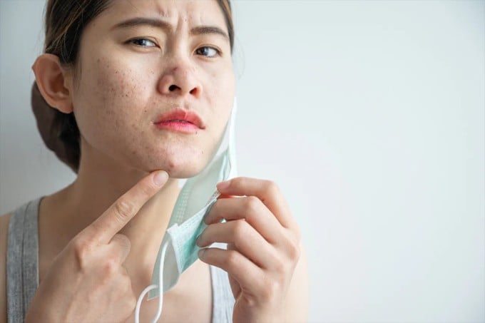 Nếu khẩu trang giấy dùng quá lâu hoặc khẩu trang vải không được giặt sạch hằng ngày, vi khuẩn, bụi bẩn và hơi ẩm sẽ tích tụ nhanh chóng.