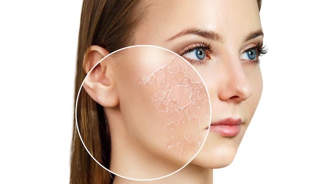  Khi cấu trúc da trở nên săn chắc hơn, lỗ chân lông cũng có xu hướng trông gọn gàng và ít bít tắc hơn.