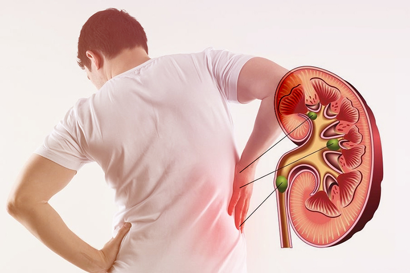 Dấu hiệu nhận biết bệnh thận