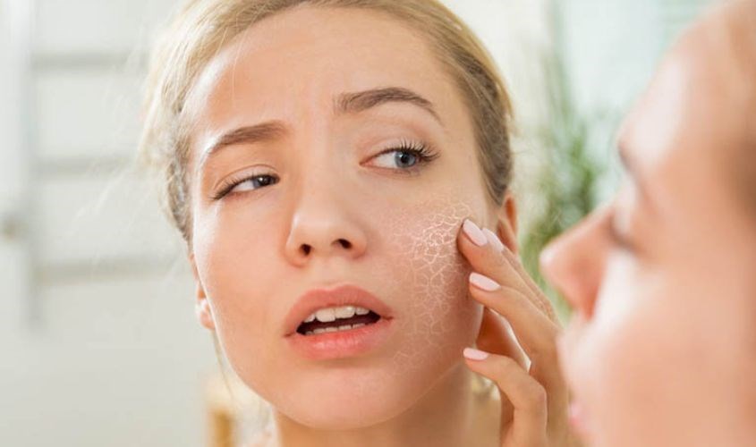 Da xỉn màu, thiếu căng bóng và xuất hiện các nếp nhăn li ti thường là dấu hiệu cho thấy Mừng SHBET phiên bản mới 2025 đang thiếu nước nghiêm trọng. 