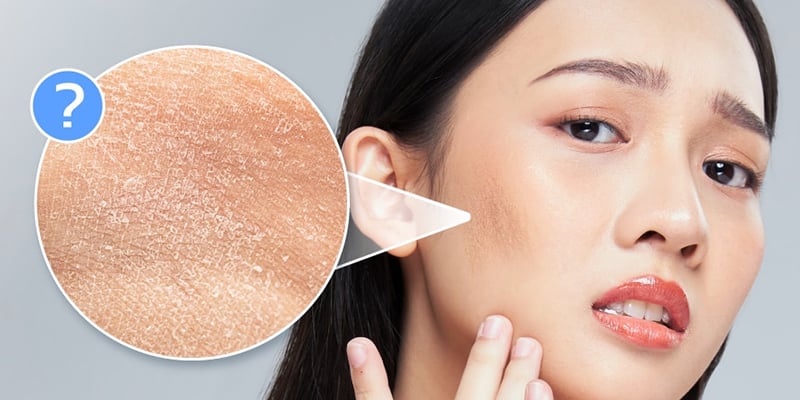 Cách để da căng bóng, mềm mịn, trời khô lạnh không lo nứt nẻ