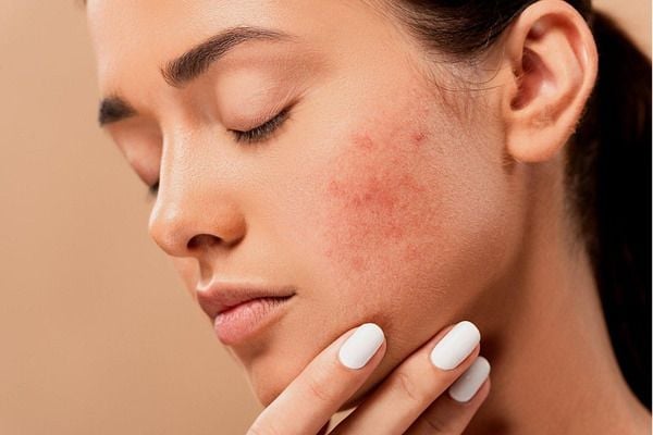 Thành phần nổi bật nhất của loại dầu này là acid retinoic, một dẫn xuất tự nhiên của vitamin A, có khả năng thúc đẩy quá trình tái tạo tế bào da 