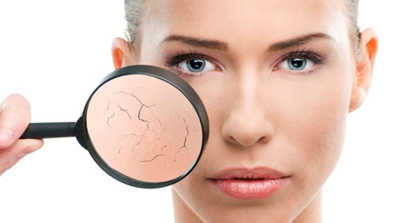  Dù không gây nguy hiểm về mặt y khoa, các đốm nắng lại là dấu hiệu rõ ràng cho thấy da đang chịu tổn thương mạn tính và bước vào giai đoạn lão hóa sớm. 