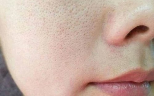 Serum đặc trị đóng vai trò quan trọng trong việc cải thiện kết cấu da.