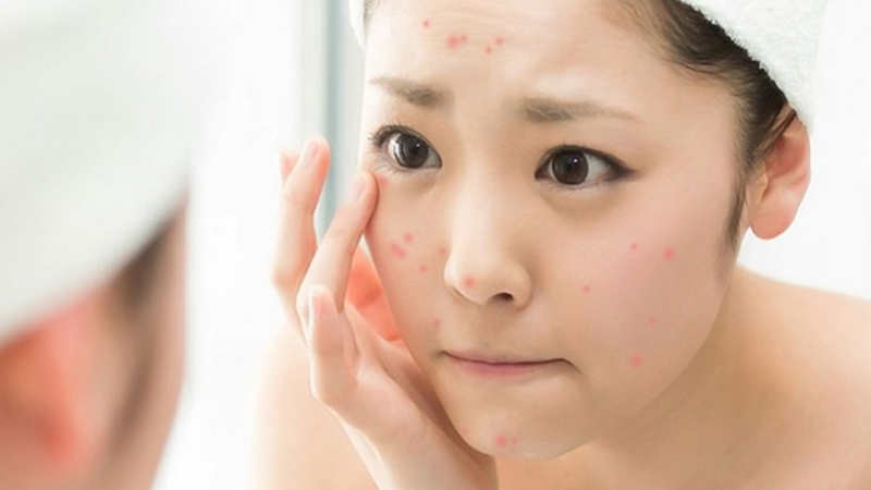 Khi da bị “bít kín”, các hoạt chất như chất chống oxy hóa hay retinoid khó phát huy tác dụng, từ đó làm chậm quá trình phục hồi tự nhiên.