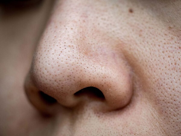 Khi da bước vào quá trình lão hóa, sự suy giảm collagen và elastin khiến cấu trúc nâng đỡ trở nên yếu đi.