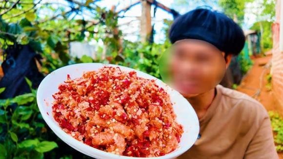 Ung thư Shbet123 Link Vào ShBet Mới Nhất phổ biến ở nam giới hơn nữ giới với tỷ lệ khoảng 2:1, thường gặp ở độ tuổi từ 60 đến 80. 