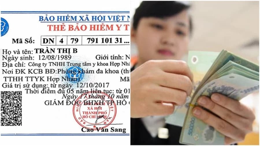 Về bản chất, “cùng chi trả” là phần chi phí mà người tham gia BHYT phải tự thanh toán theo tỷ lệ phần trăm được hưởng ghi trên thẻ BHYT. Ví dụ, nếu thẻ BHYT có mức hưởng 80%, người bệnh sẽ tự chi trả 20% chi phí nằm trong phạm vi được thanh toán của BHYT.    