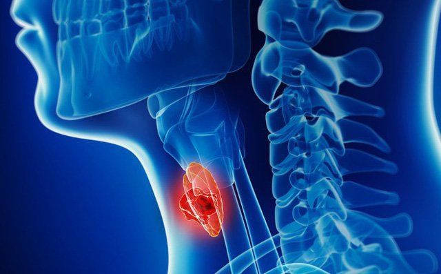 Khi có khối u tuyến giáp xuất hiện thì giọng nói sẽ bị ảnh hưởng