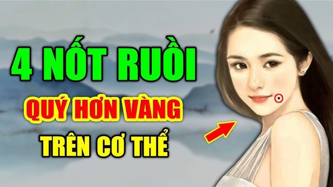 ruoi